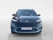 Hyundai Kona 1.6 GDI HEV Fashion Sky | Navigatie| Lichtmetalen velgen| Parkeersensoren| Schuif- kanteldak| Climate Controle| Adaptieve Cruise Controle| Dode hoeksensor|