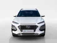 Hyundai Kona 1.0T Fashion | Speciaal interieur | Carplay | Climate control